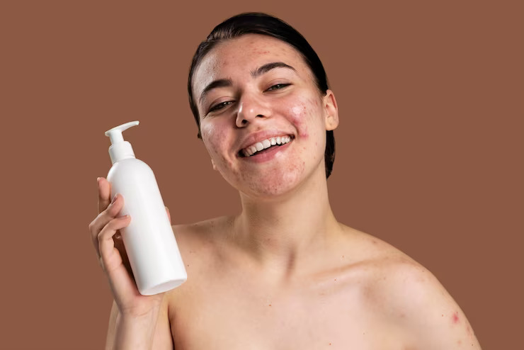 The Best Body Wash for Acne-Prone Sensitive Skin